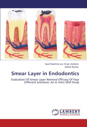 Smear Layer in Endodontics.New 9783659118036 Fast Free Shipping<| - Afbeelding 1 van 1