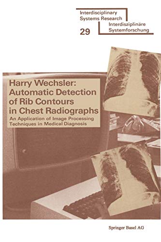 Automatic Detection of Rib Contours in Chest Ra, Wechsler,, Świetna wartość, nowość