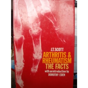 Arthritis and Rheumatism: The Facts