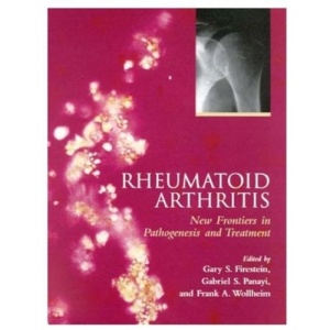 Rheumatoid Arthritis: New Frontiers in Pathogenesis and Treatment