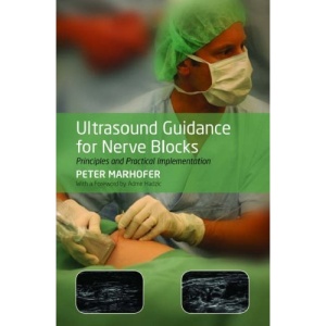 Ultrasound Guidance for Nerve Blocks: Principles and Practical Implementation