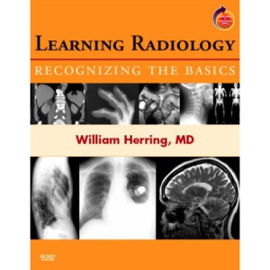 Learning Radiology: Recognizing the Basics: With STUDENT CONSULT Online Access