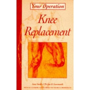 Knee Replacement (Your Operation)