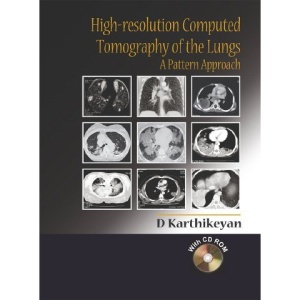 High-resolution Computed Tomography of the Lungs: A Pattern Approach
