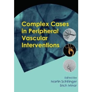Complex Cases in Peripheral Vascular Interventions