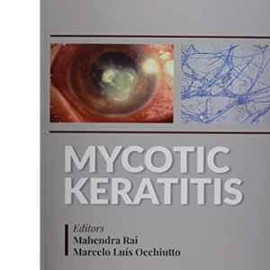 Mycotic Keratitis