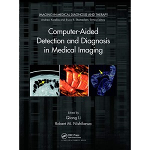 Computer-Aided Detection and Diagnosis in Medical Imaging