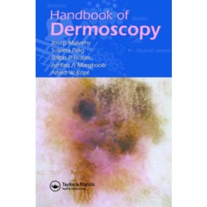 Handbook of Dermoscopy