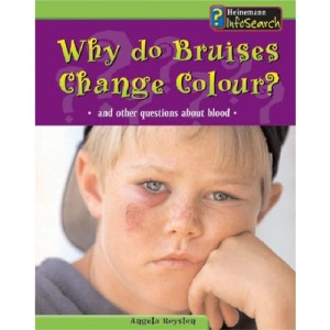 Why Do Bruises Change Colour? (Body Matters)
