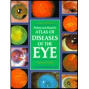 Atlas of Diseases of the Eye