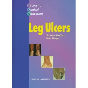 Leg Ulcers (Access to Clinical Education)