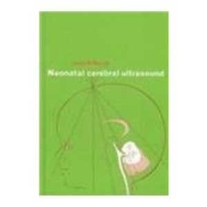 Neonatal Cerebral Ultrasound