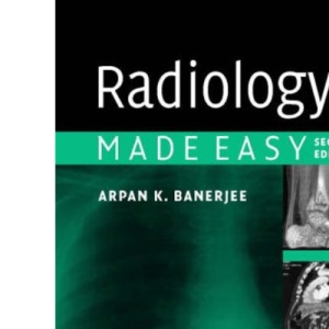 Radiology Made Easy, Second Edition