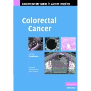Colorectal Cancer (Contemporary Issues in Cancer Imaging)