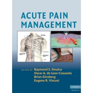 Acute Pain Management (Cambridge Medicine)