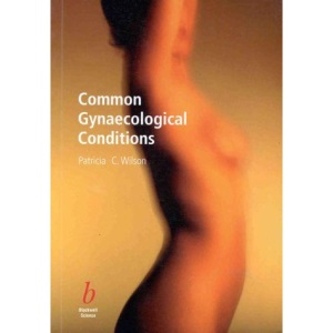 Common Gynaecological Conditions