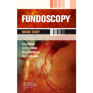 Fundoscopy Made Easy
