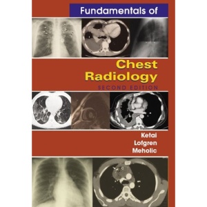 Fundamentals of Chest Radiology (Fundamentals of Radiology)