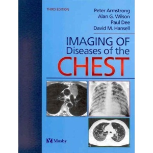 Imaging of Diseases of the Chest