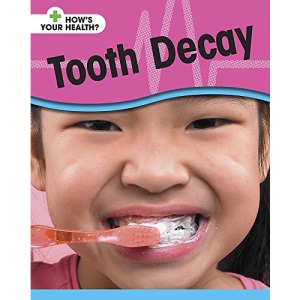 Tooth Decay (How's Your Health)