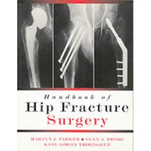 Handbook of Hip Fracture Surgery