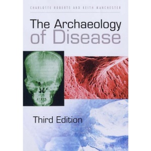 The Archaeology of Disease
