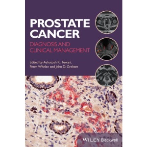 Prostate Cancer: Diagnosis and Clinical Management