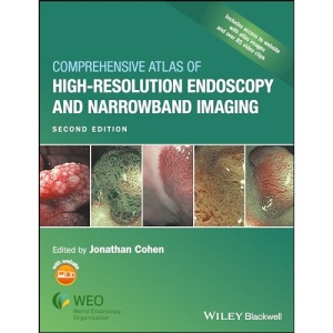 Comprehensive Atlas of High Resolution Endoscopy and Narrowband Imaging