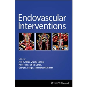 Endovascular Interventions