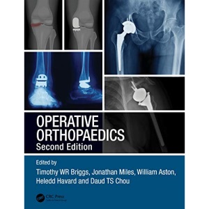 Operative Orthopaedics