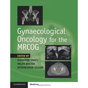 Gynaecological Oncology for the MRCOG