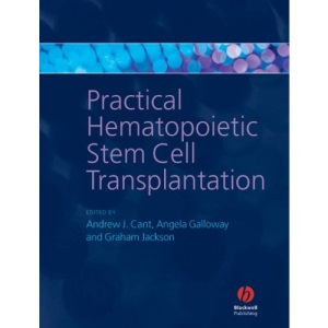 Practical Hematopoietic Stem Cell Transplantation