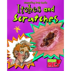 Itches and Scratches (Read Me: Disgusting Body Facts)