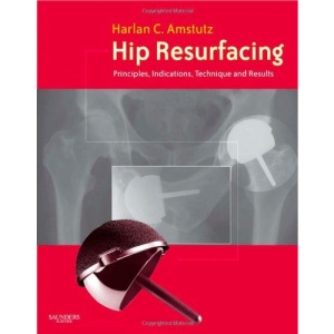 Hip Resurfacing: Principles, Indications, Technique and Results Book and DVD