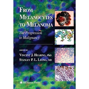 From Melanocytes to Melanoma: The Progression to Malignancy