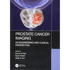 Prostate Cancer Imaging: An Engineering and Clinical Perspective