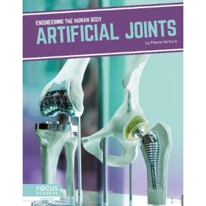 Artificial Joints (Engineering the Human Body)
