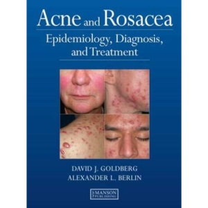 Acne and Rosacea: Epidemiology, Diagnosis and Treatment