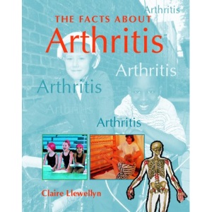 Facts About Arthritis