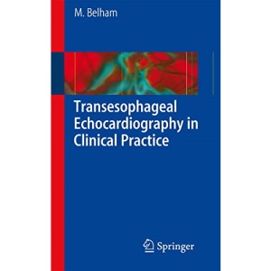 Transesophageal Echocardiography in Clinical Practice