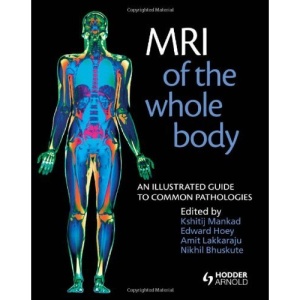 MRI of the Whole Body: An Illustrated Guide to Common Pathologies