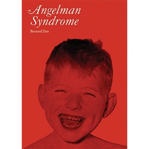 Angelman Syndrome (Clinics in Developmental Medicine): 177
