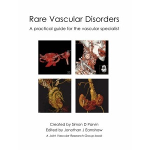 Rare Vascular Disorders: A Practical Guide for the Vascular Specialist