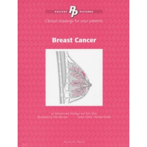 Patient Pictures: Breast Cancer: (Patient Pictures series): Clinical Drawings for Your Patients