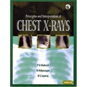 Principles and Interpretation of Chest X-rays
