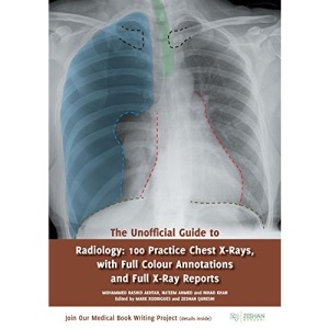 The Unofficial Guide to Radiology: 100 Practice Chest X Rays with Full Colour Annotations and Full X Ray Reports (Unofficial Guides to Medicine)