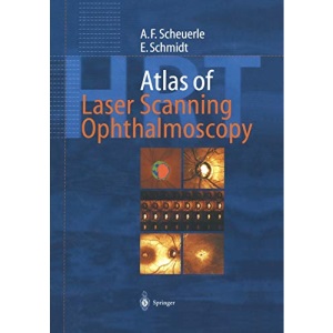 Atlas of Laser Scanning Ophthalmoscopy