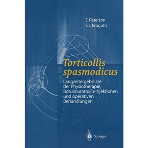 Torticollis spasmodicus: Langzeitergebnisse der Physiotherapie, Botulinumtoxin-Injektionen und operativen Behandlungen