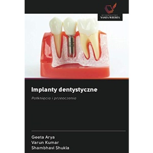 Implanty dentystyczne: Potknięcia i przeoczenia: Potkni¿cia i przeoczenia