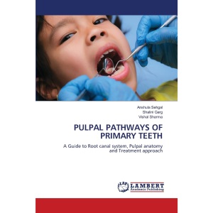 PULPAL PATHWAYS OF PRIMARY TEETH: A Guide to Root canal system, Pulpal anatomy and Treatment approach